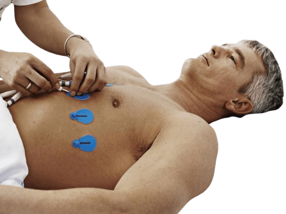 Ambu Blue Sensor ECG Electrodes - Single Use