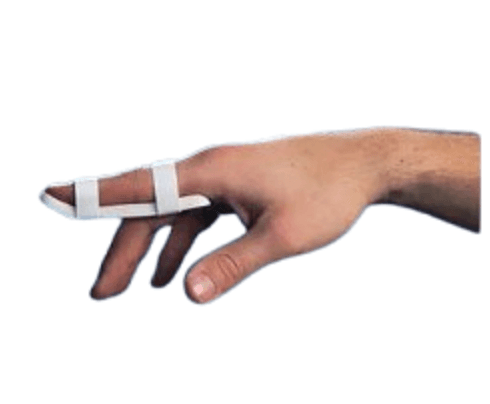 A-3 Plastalume Digital Zimmer Splint - 3.25" / 83mm (12)