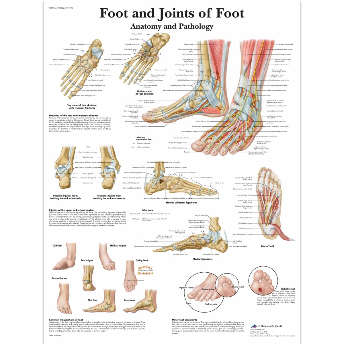 Educational Poster - Foot and Joints of Foot Chart - Laminated