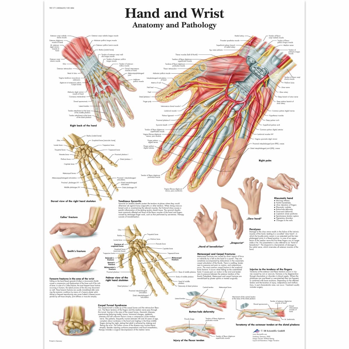 Educational Poster - Hand and Wrist Chart - Laminated